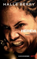 Herida